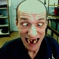 Click image for larger version

Name:	bad teeth.jpg
Views:	4
Size:	30.1 KB
ID:	457458