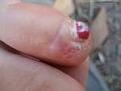 Click image for larger version

Name:	toe.jpg
Views:	4
Size:	3.9 KB
ID:	529627